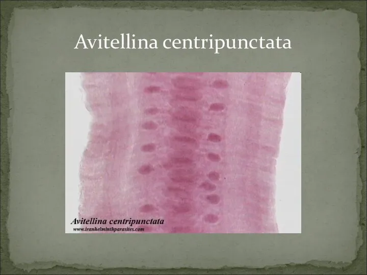Avitellina centripunctata