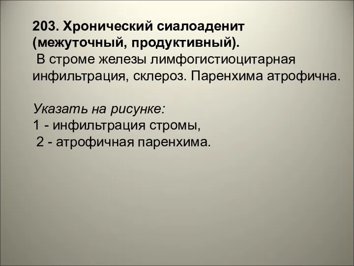 203. Хронический сиалоаденит (межуточный, продуктивный). В строме железы лимфогистиоцитарная инфильтрация,