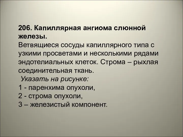 206. Капиллярная ангиома слюнной железы. Ветвящиеся сосуды капиллярного типа с