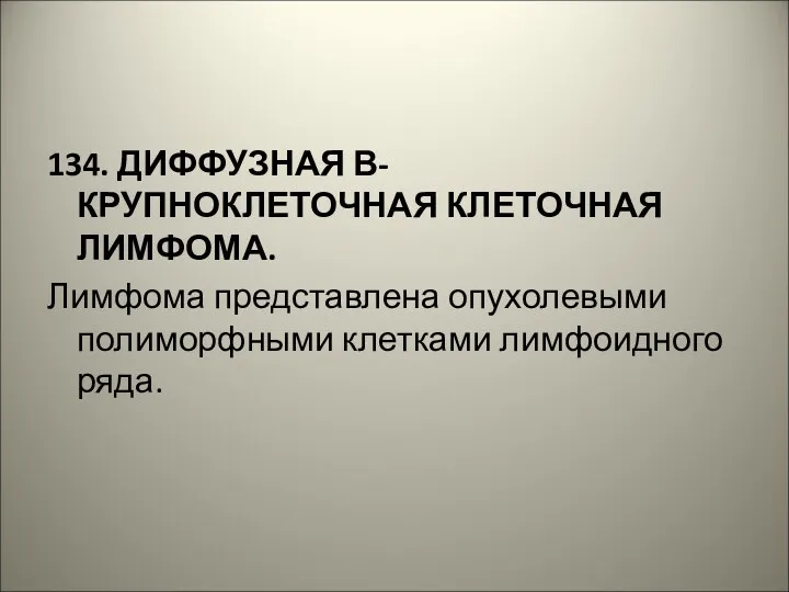 134. ДИФФУЗНАЯ В- КРУПНОКЛЕТОЧНАЯ КЛЕТОЧНАЯ ЛИМФОМА. Лимфома представлена опухолевыми полиморфными клетками лимфоидного ряда.