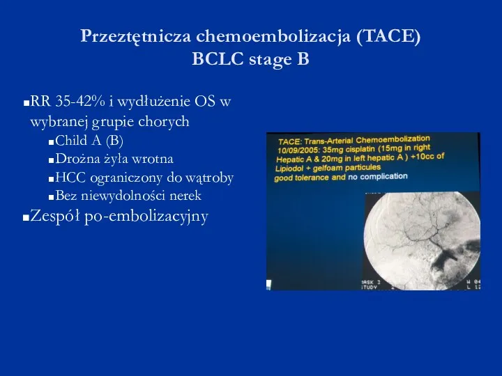 Przeztętnicza chemoembolizacja (TACE) BCLC stage B RR 35-42% i wydłużenie OS w wybranej