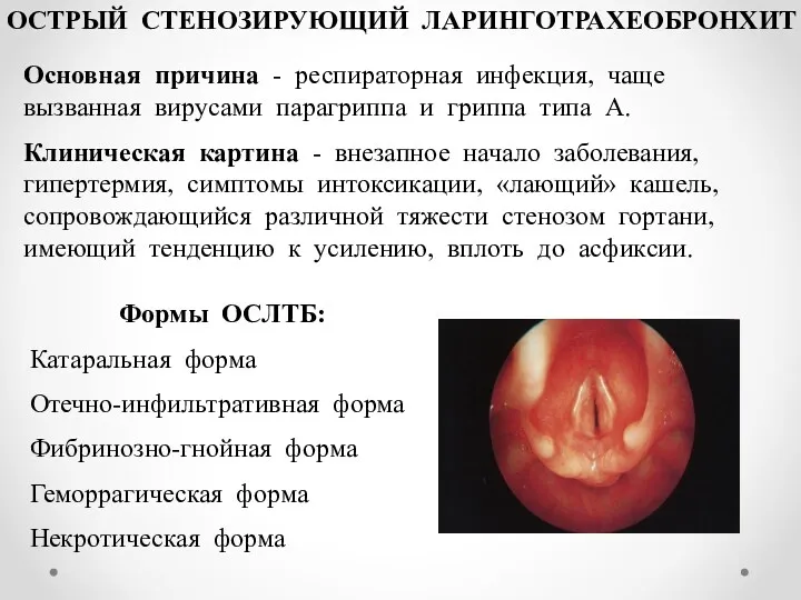 ОСТРЫЙ СТЕНОЗИРУЮЩИЙ ЛАРИНГОТРАХЕОБРОНХИТ Основная причина - респираторная инфекция, чаще вызванная вирусами парагриппа и