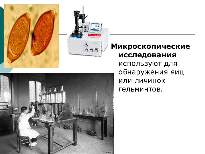 Микроскопические исследования используют для обнаружения яиц или личинок гельминтов.