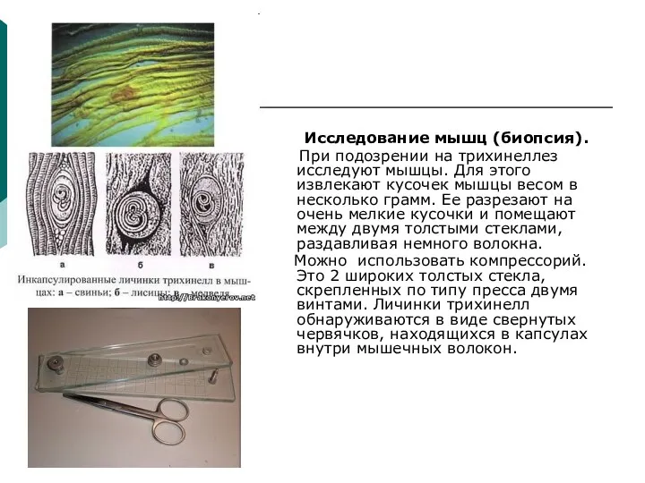 Исследование мышц (биопсия). При подозрении на трихинеллез исследуют мышцы. Для