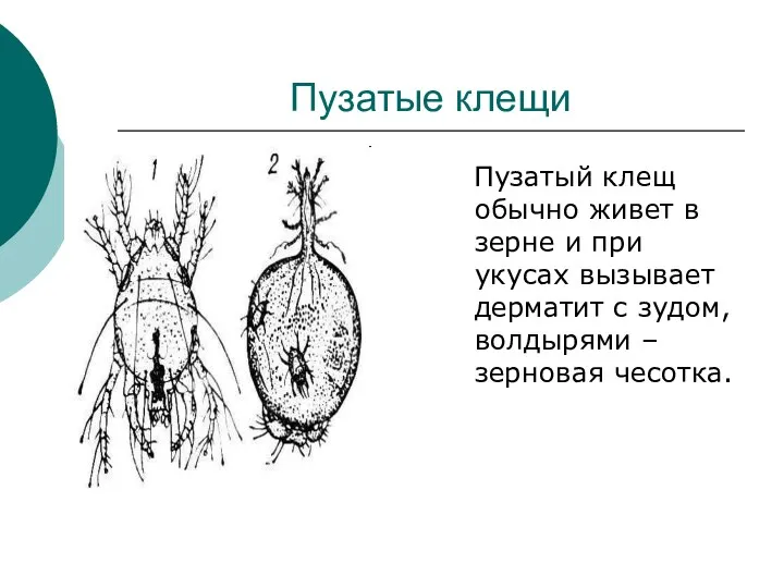 Пузатые клещи Пузатый клещ обычно живет в зерне и при укусах вызывает дерматит