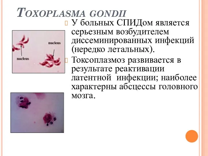 Toxoplasma gondii У больных СПИДом является серьезным возбудителем диссеминированных инфекций