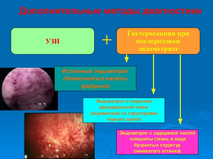 Дополнительные методы диагностики + Гистероскопия при послеродовом эндометрите УЗИ Истинный эндометрит (белесоватые налеты
