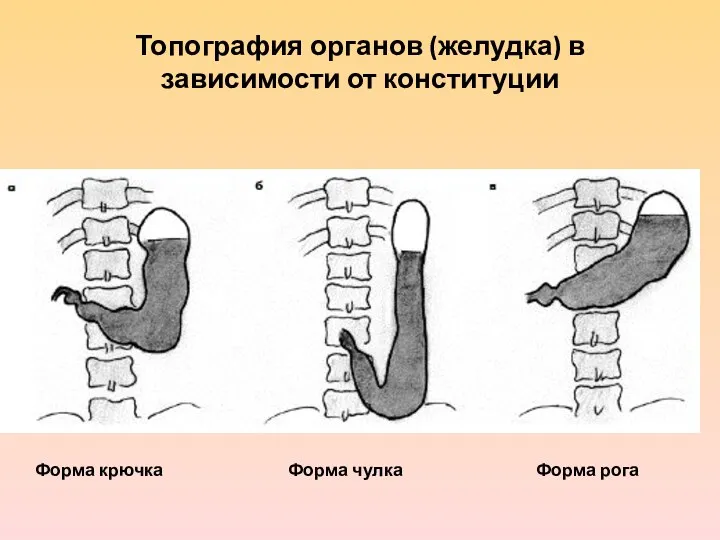 Топография органов (желудка) в зависимости от конституции Форма крючка Форма чулка Форма рога