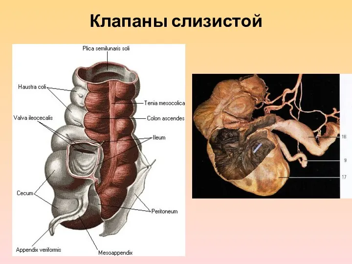 Клапаны слизистой