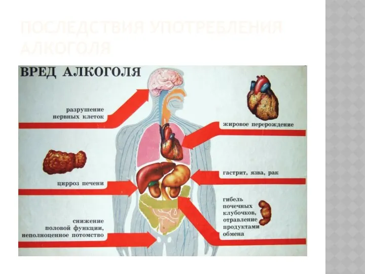 ПОСЛЕДСТВИЯ УПОТРЕБЛЕНИЯ АЛКОГОЛЯ