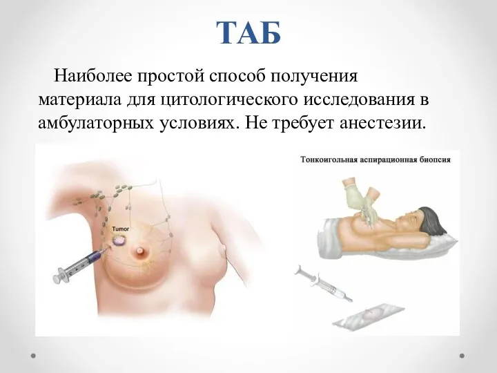 ТАБ Наиболее простой способ получения материала для цитологического исследования в амбулаторных условиях. Не требует анестезии.