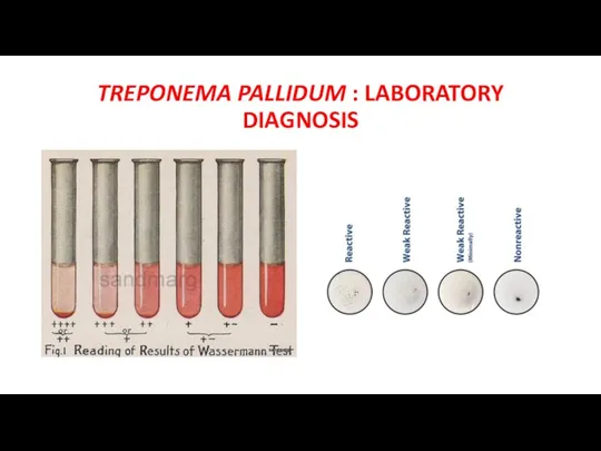 TREPONEMA PALLIDUM : LABORATORY DIAGNOSIS