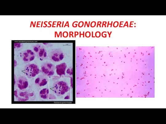 NEISSERIA GONORRHOEAE: MORPHOLOGY