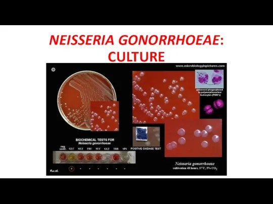 NEISSERIA GONORRHOEAE: CULTURE