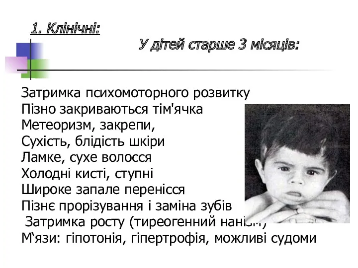 1. Клінічні: У дітей старше 3 місяців: Затримка психомоторного розвитку