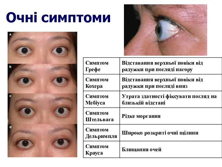 Очні симптоми