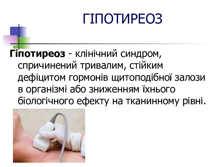 ГІПОТИРЕОЗ Гіпотиреоз - клінічний синдром, спричинений тривалим, стійким дефіцитом гормонів