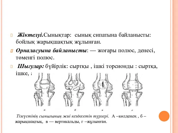 Жіктелуі.Сынықтар: сынық сипатына байланысты: бойлық жарықшақтық жұлынған. Орналасуына байланысты: —