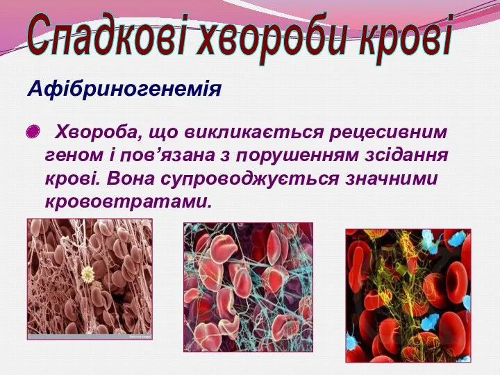 Афібриногенемія Хвороба, що викликається рецесивним геном і пов’язана з порушенням