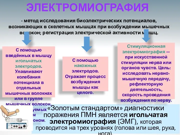 «Золотым стандартом» диагностики поражения ПМН является игольчатая электромиография (ЭМГ), которая