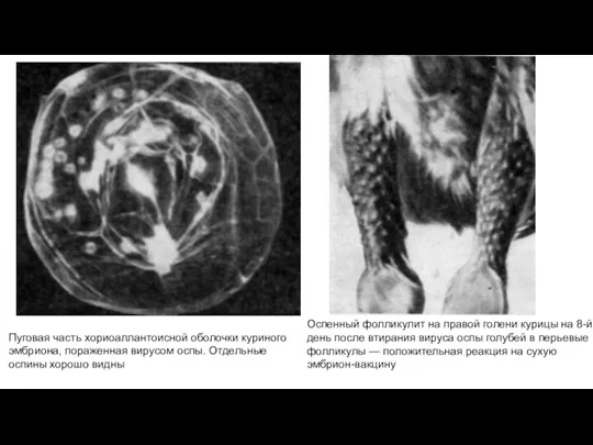 Пуговая часть хориоаллантоисной оболочки куриного эмбриона, пораженная вирусом оспы. Отдельные оспины хорошо видны