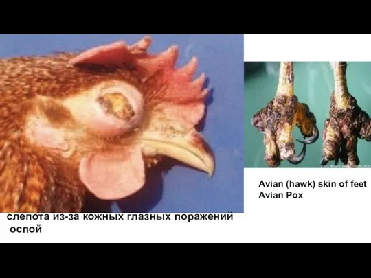 слепота из-за кожных глазных поражений оспой Avian (hawk) skin of feet Avian Pox