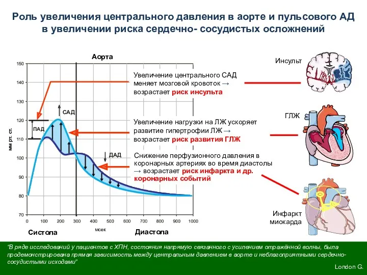 ПАД мсек Систола Аорта Диастола САД ДАД Роль увеличения центрального