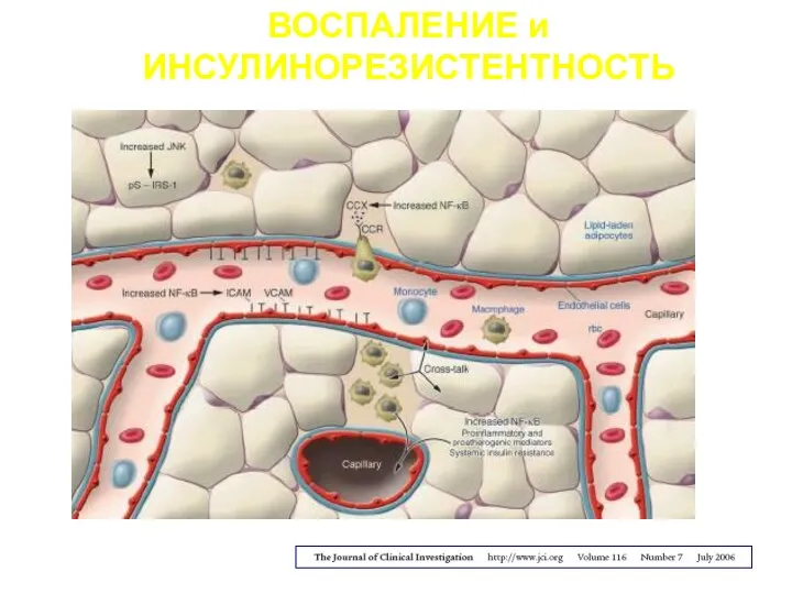 ВОСПАЛЕНИЕ и ИНСУЛИНОРЕЗИСТЕНТНОСТЬ