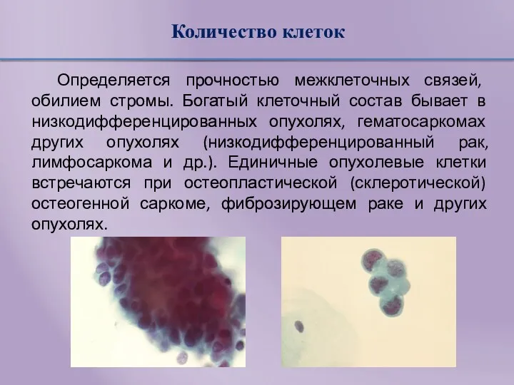 Количество клеток Определяется прочностью межклеточных связей, обилием стромы. Богатый клеточный