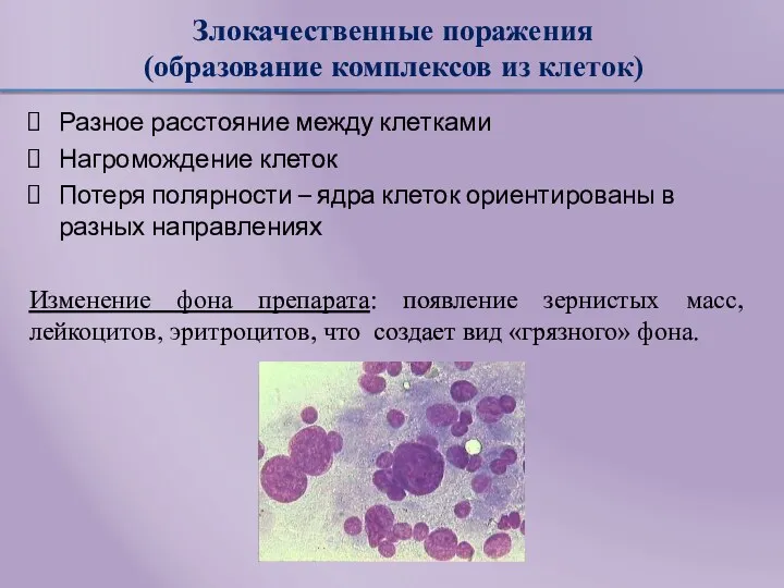 Злокачественные поражения (образование комплексов из клеток) Разное расстояние между клетками