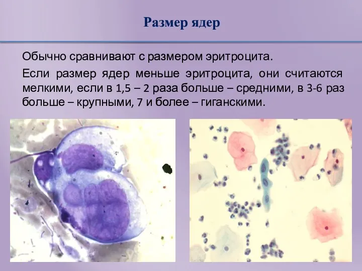 Размер ядер Обычно сравнивают с размером эритроцита. Если размер ядер