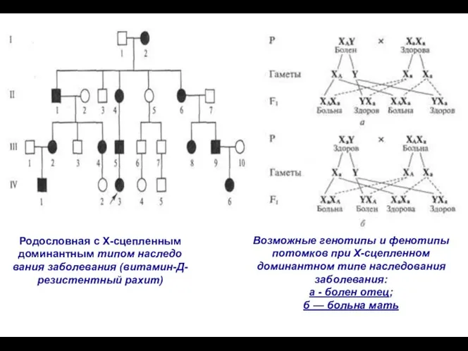 Родословная с Х-сцепленным доминантным типом наследо­вания заболевания (витамин-Д-резистентный рахит) Возможные