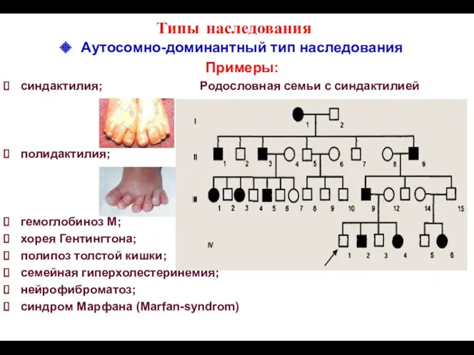 Типы наследования Аутосомно-доминантный тип наследования Примеры: синдактилия; Родословная семьи с