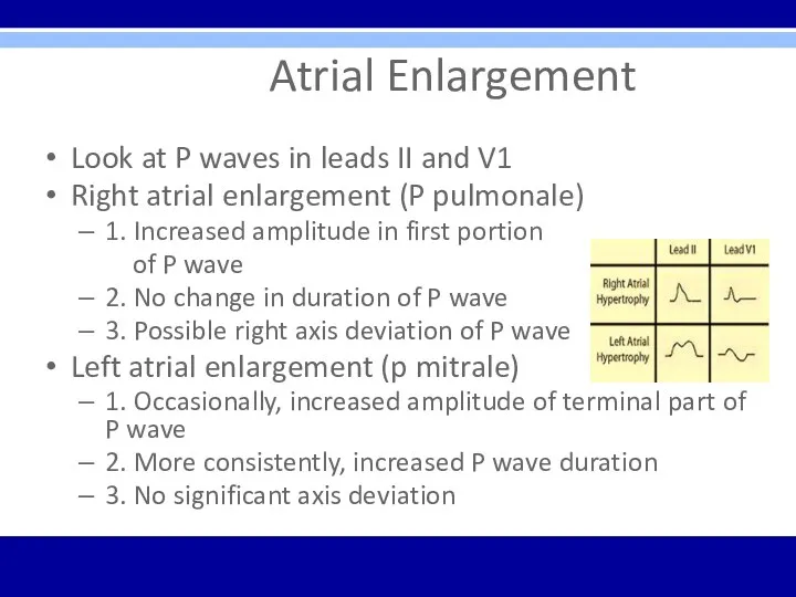 Atrial Enlargement Look at P waves in leads II and