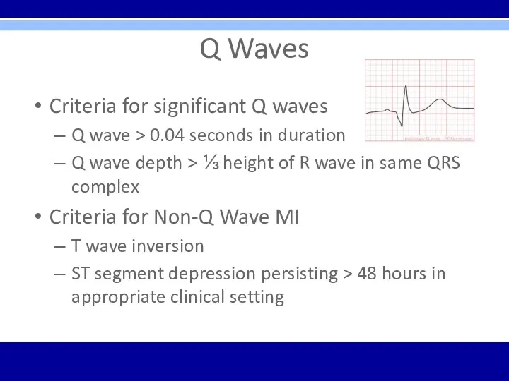 Q Waves Criteria for significant Q waves Q wave >