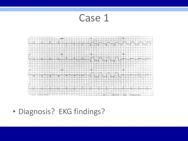 Case 1 Diagnosis? EKG findings?