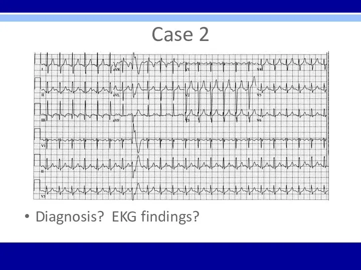 Case 2 Diagnosis? EKG findings?