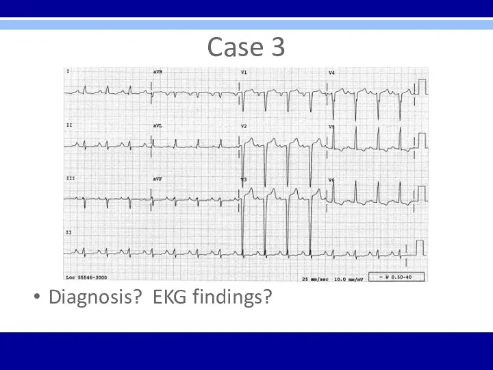 Case 3 Diagnosis? EKG findings?