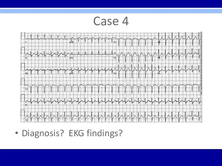 Case 4 Diagnosis? EKG findings?