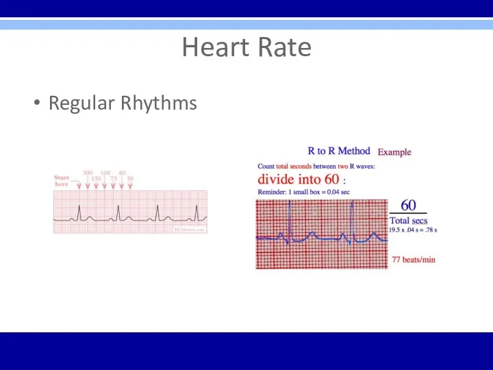 Heart Rate Regular Rhythms