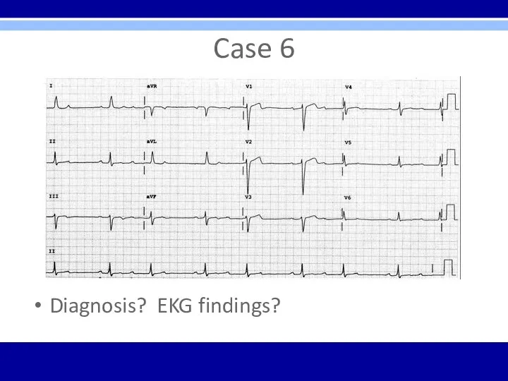 Case 6 Diagnosis? EKG findings?