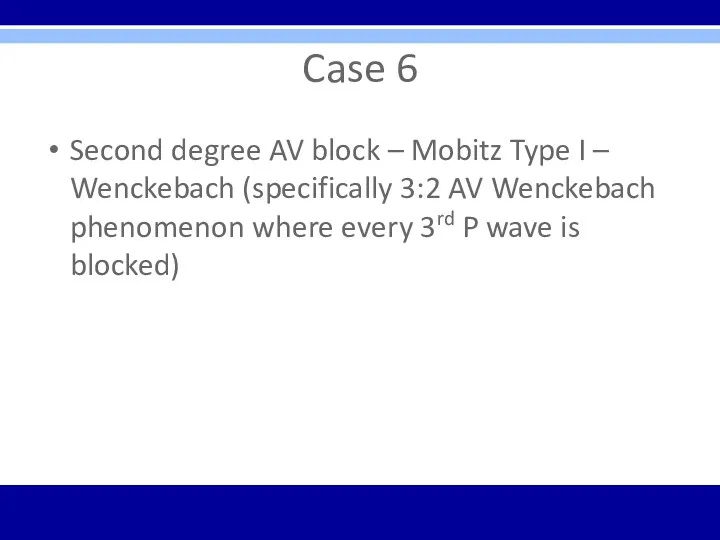 Case 6 Second degree AV block – Mobitz Type I