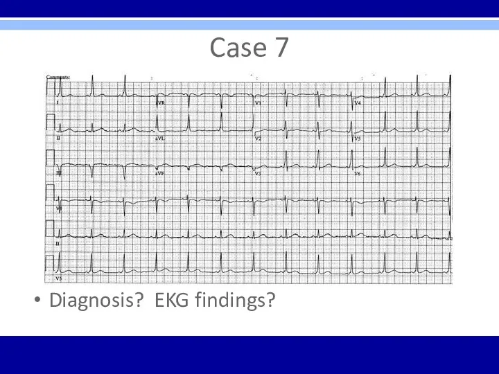 Case 7 Diagnosis? EKG findings?