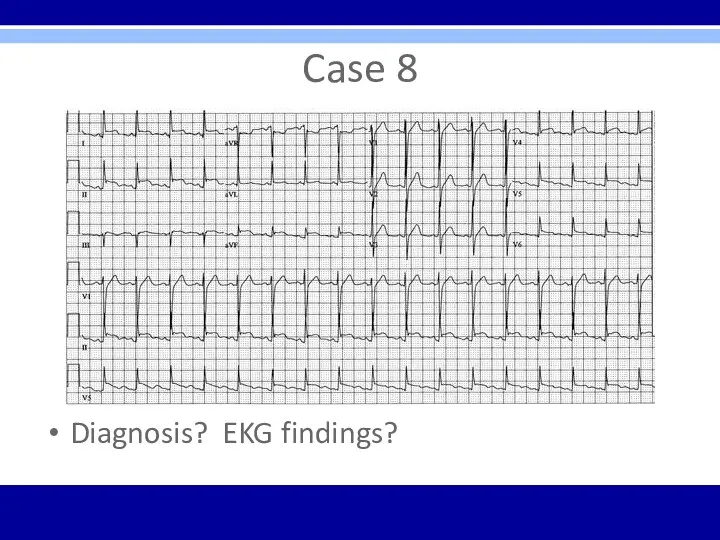 Case 8 Diagnosis? EKG findings?