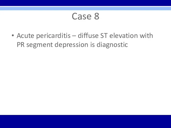 Case 8 Acute pericarditis – diffuse ST elevation with PR segment depression is diagnostic