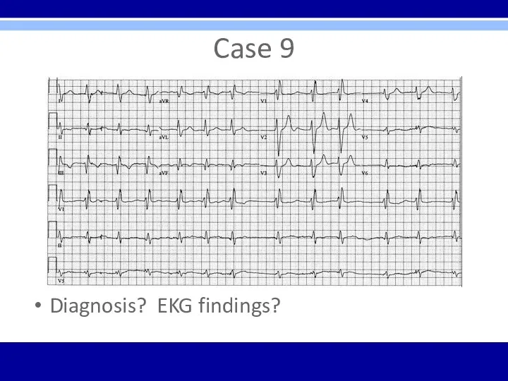 Case 9 Diagnosis? EKG findings?