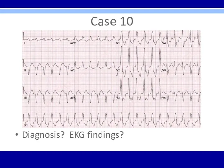 Case 10 Diagnosis? EKG findings?