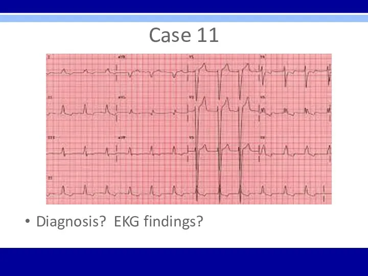 Case 11 Diagnosis? EKG findings?