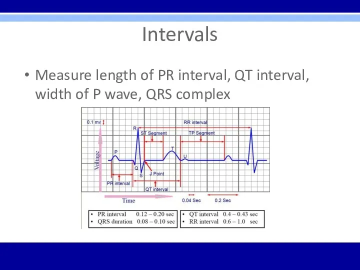 Intervals Measure length of PR interval, QT interval, width of P wave, QRS complex