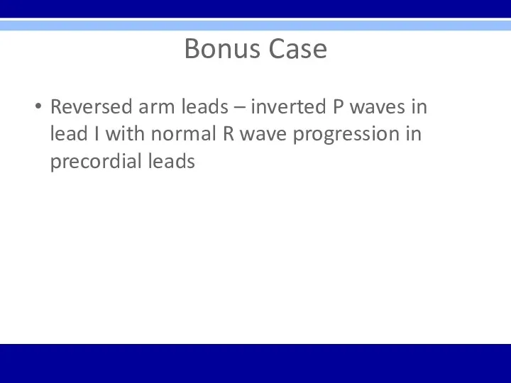 Bonus Case Reversed arm leads – inverted P waves in